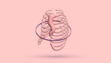 A 3D rib cage with a ring encircling it at the level of the lower ribs