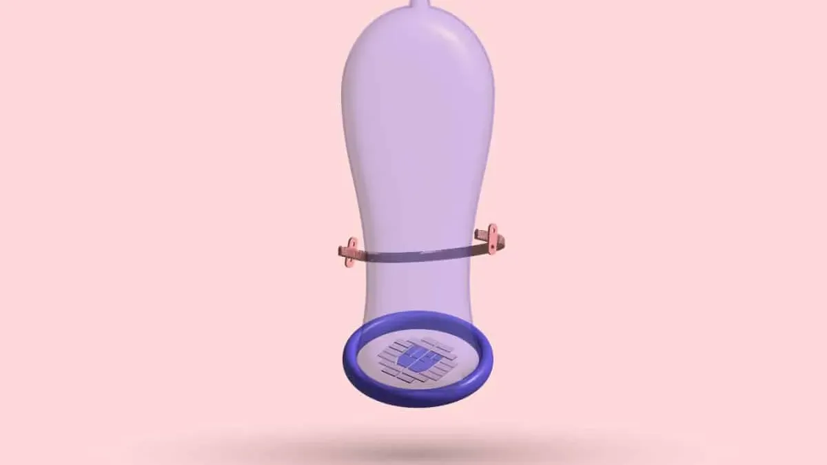 A 3D condom with a Nuss bar strapped around it