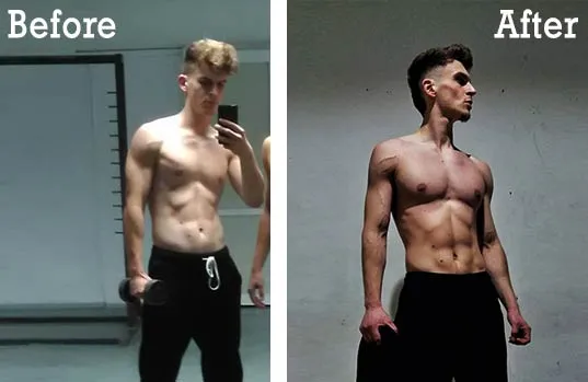 Mihail Veleski's ribcage before and after corrective training and bracing